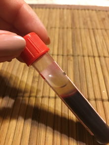最好用的浅圆铲子品牌大解析